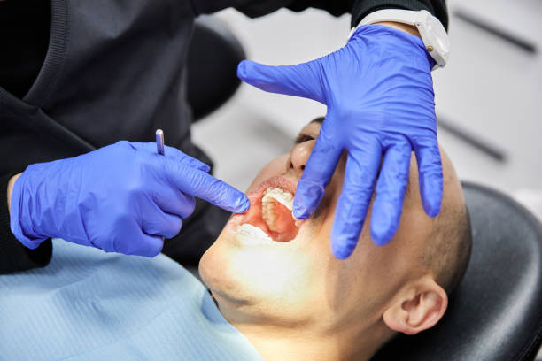 Best Emergency Treatment for Dental Infections or Abscesses in Hillcrest Heights, MD